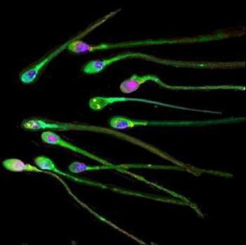 human sperm