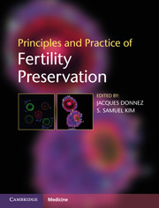 principles-and-practice-of-fertility-preservation.180x236