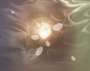 Low sperm count